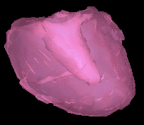 VRML heart from Focus  Imaging